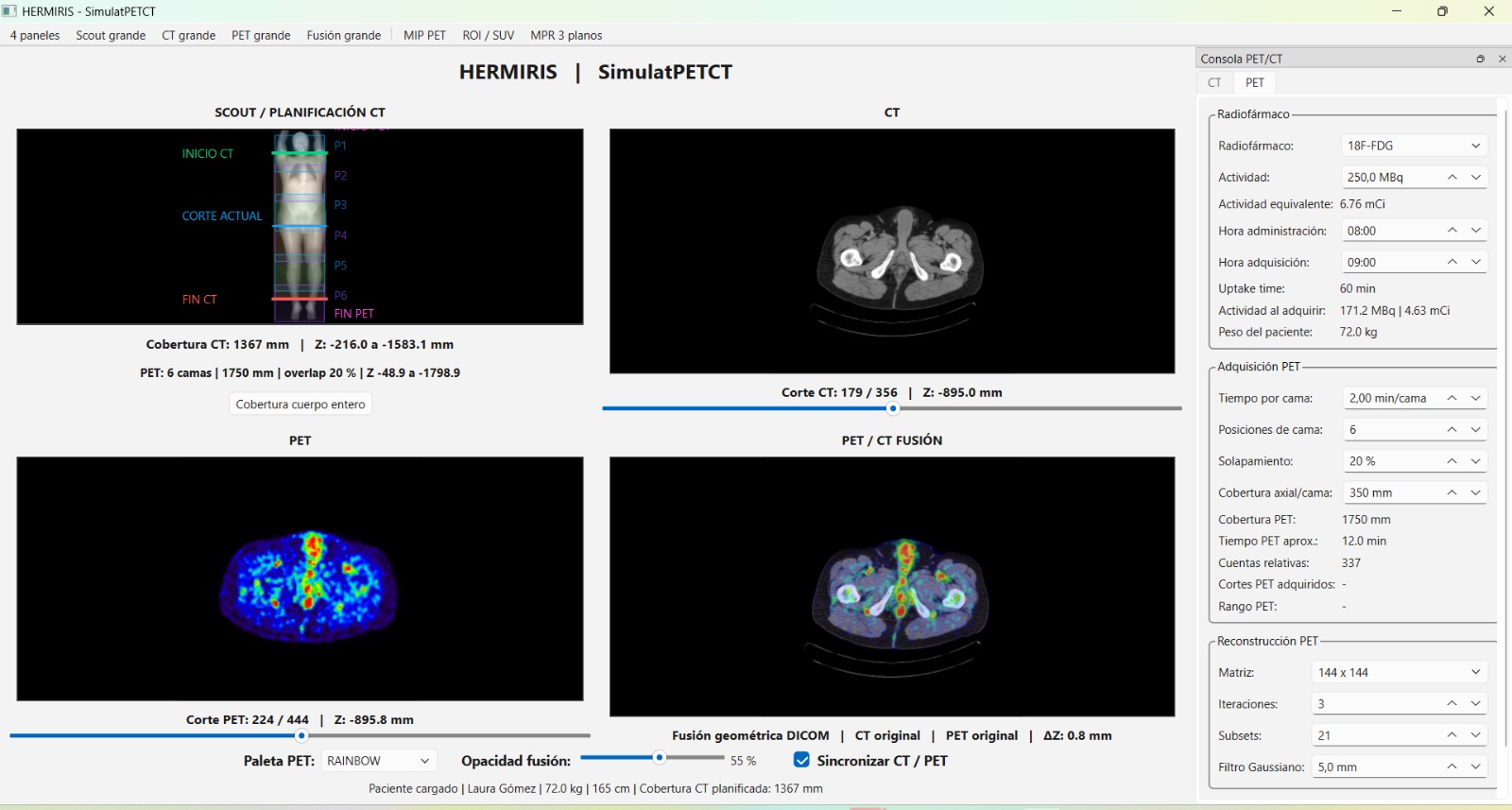 SimulatPETCT